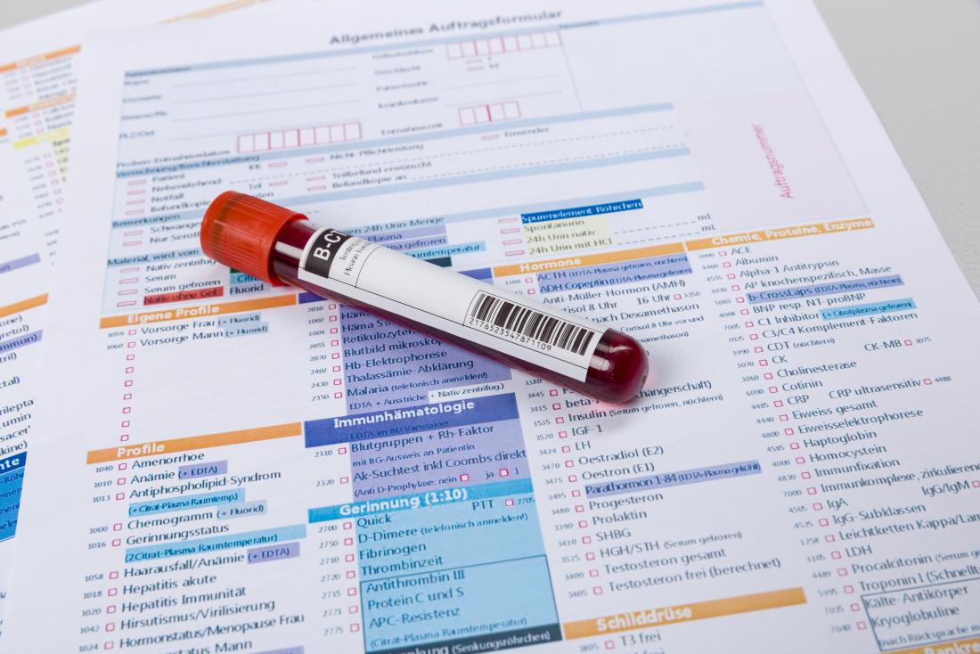 Fiala di campione di sangue per il test HCV.
