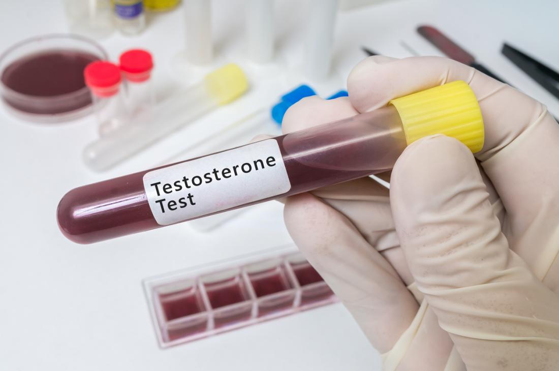 Test del testosterone