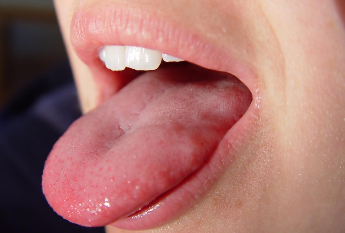 人の舌が突き出て舌が刺さっている。