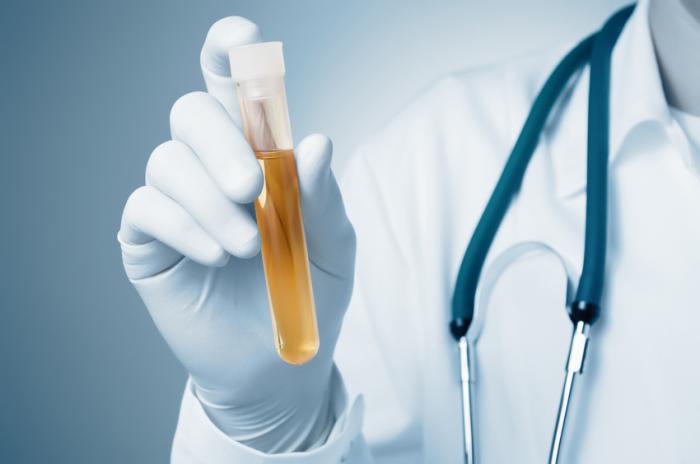Un médecin tient un échantillon d'urine dans un tube à essai
