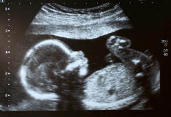 Scan eines Babys in der Gebärmutter