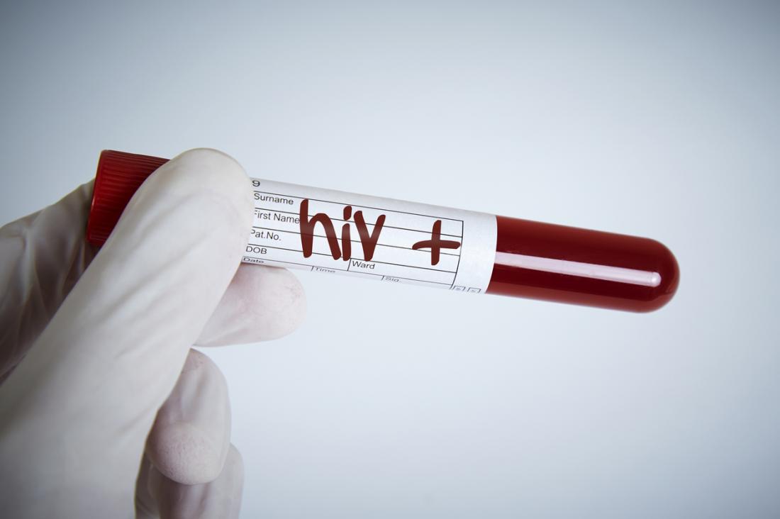 Campione di sangue HIV