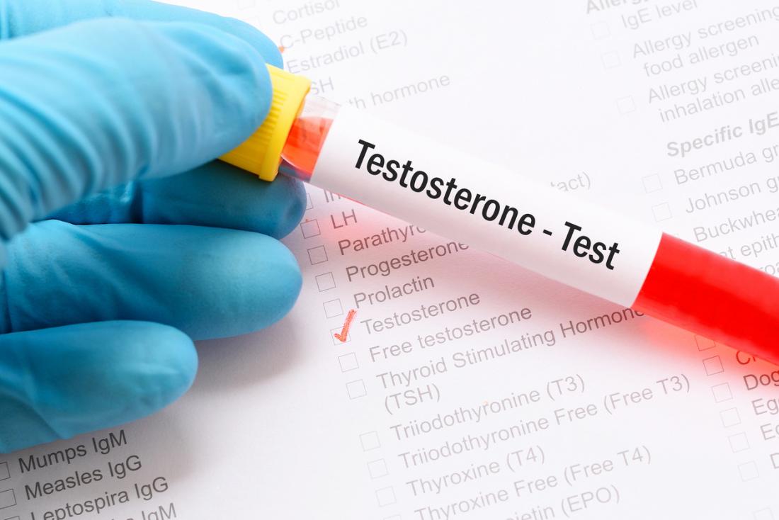 Testosteron Reagenzglas