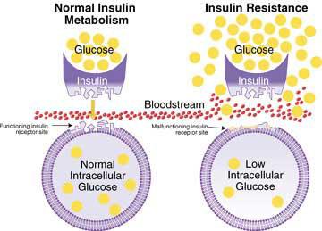Insulinresistenz