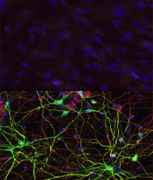 Hautzellen und Neuronen