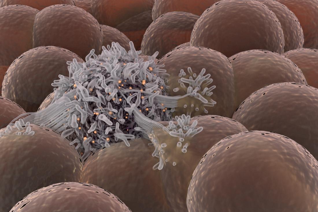 diffusione delle cellule tumorali