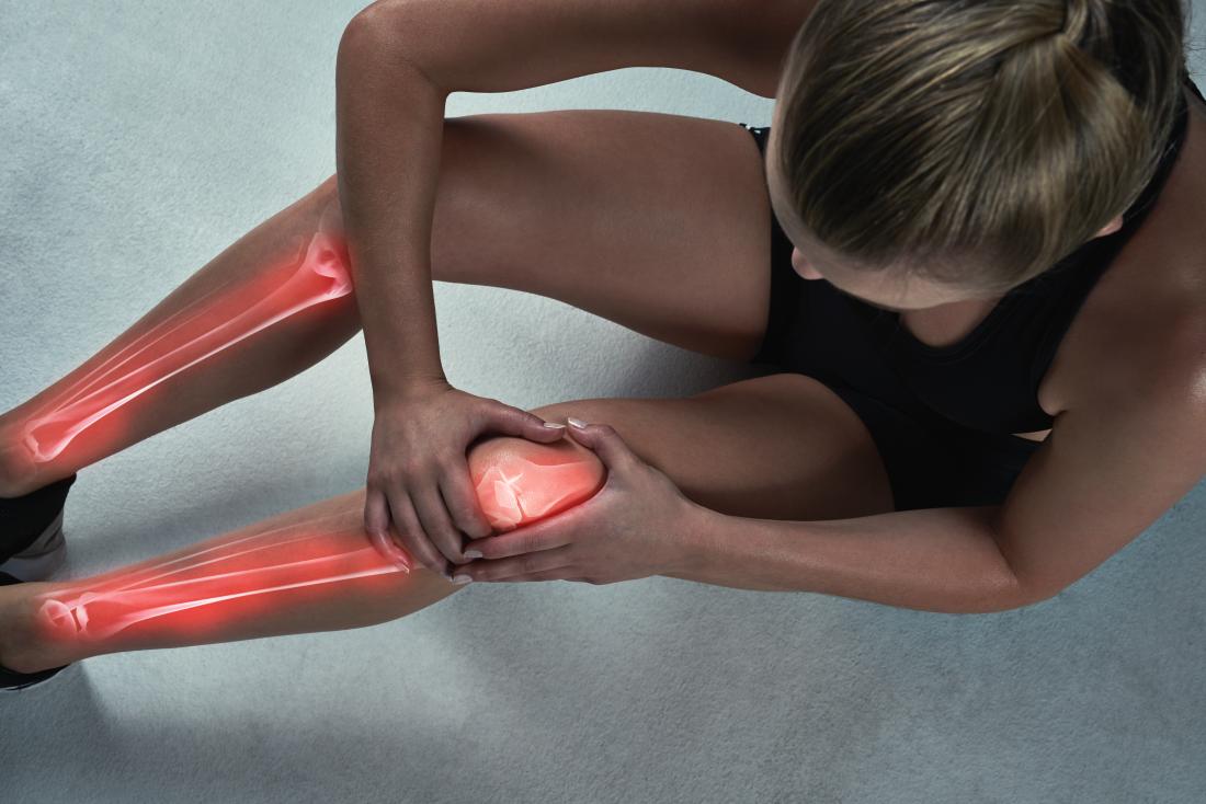Femme tenant ses jambes en raison de la douleur osseuse