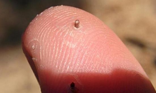 ウニの刺しが追い出されて皮膚を形成する。 